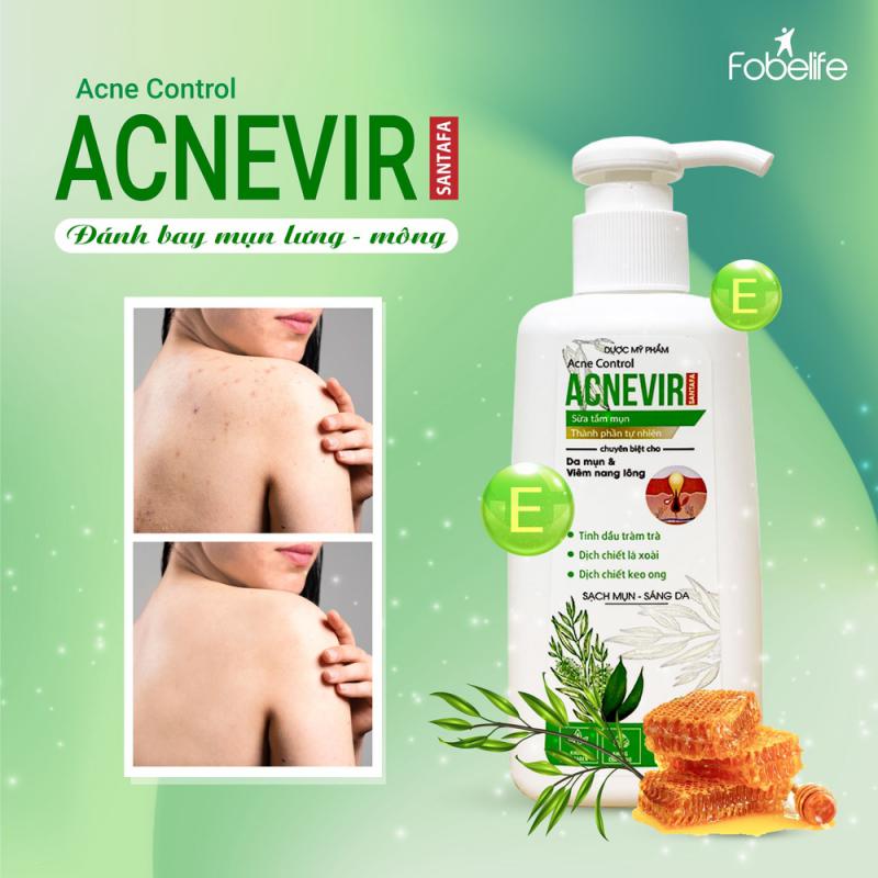 SỮA TẮM CHUYÊN BIỆT CHO DA MỤN ACNEVIR - SANTAFA SỮA TẮM CHUYÊN BIỆT CHO DA MỤN ACNEVIR - SANTAFA