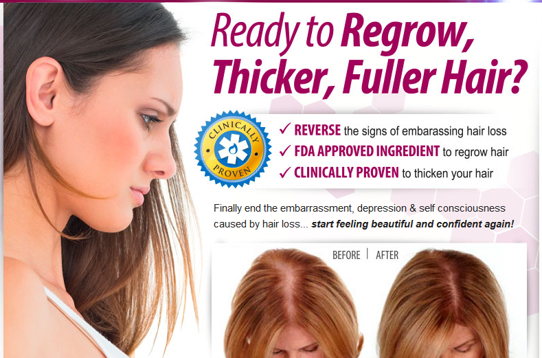 How Keranique Works Hair Loss? Try These Hair Regrowth Products from