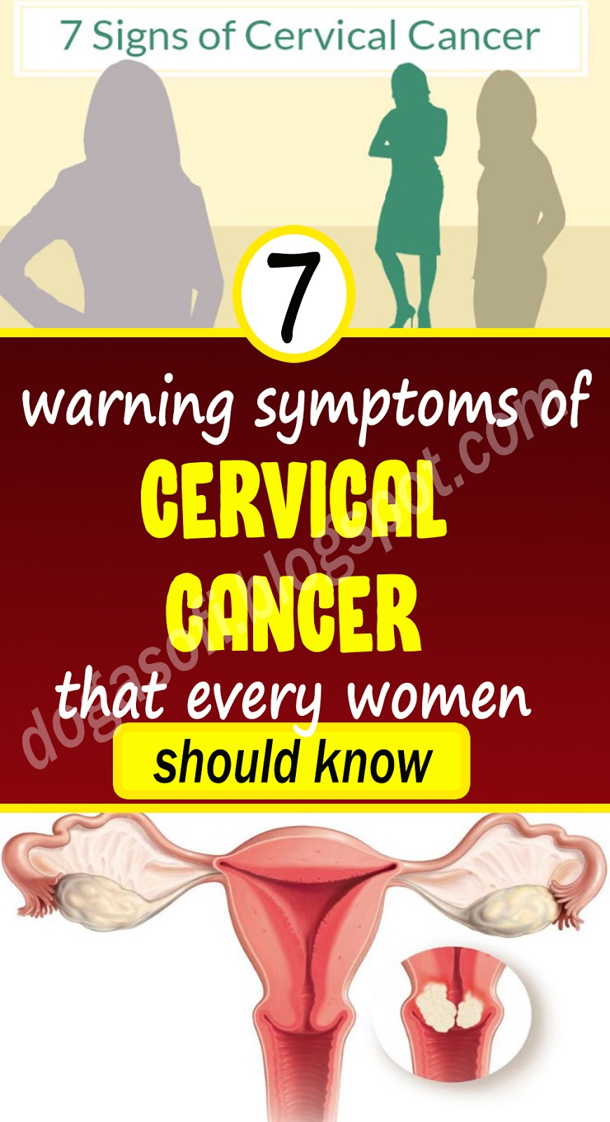 Warning signs of cervical cancer
