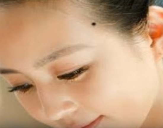 #1. A mole around the temple represents travelling. - These Moles On Your Body May Reveal Secrets About Your Life. #1. A mole around the temple represents travelling. - These Moles On Your Body May Reveal Secrets About Your Life.