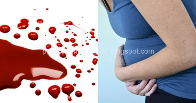 Arti Mimpi Hamil Kemudian Keguguran MIMPICA