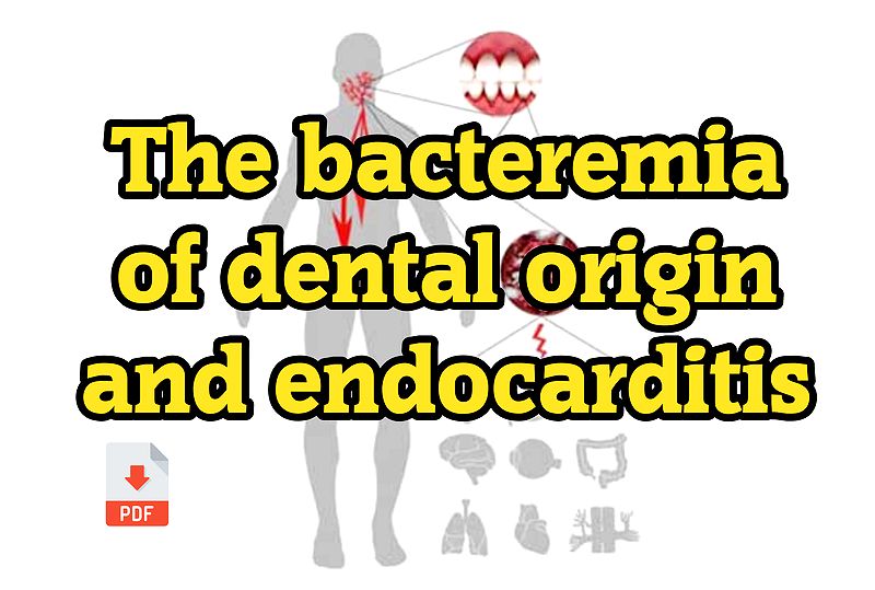 PDF The bacteremia of dental origin and its implications in the