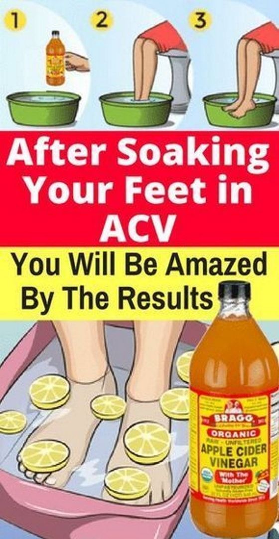 Soak Your Feet In Apple Cider Vinegar You Will Be Amazed When You See