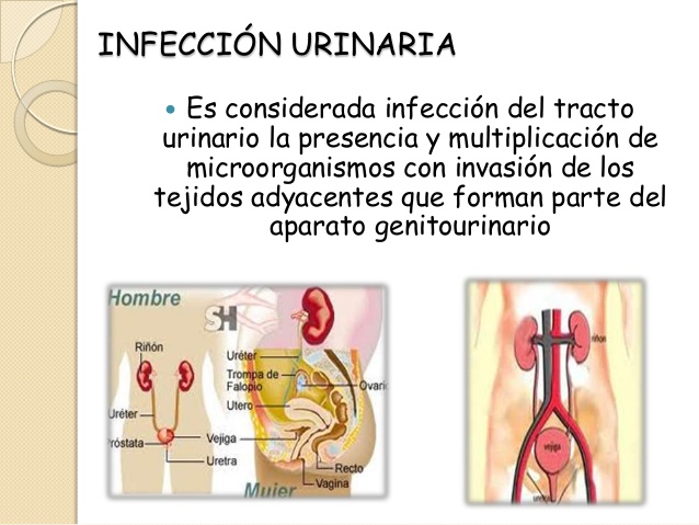 infeccion urinaria
