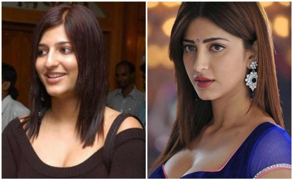 Shruti Hassan Plastic Surgery Before And After Photo ~ Celebrity