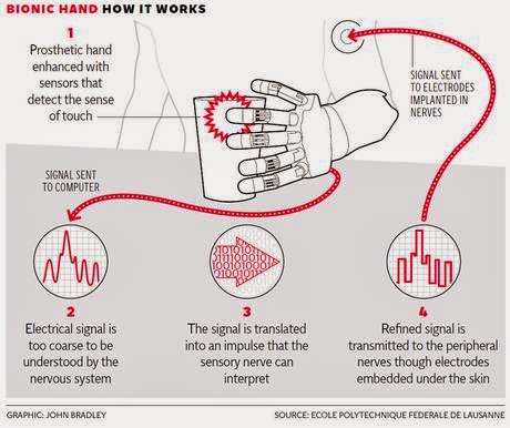 THE IRONIC TRUTH: The bionic hand: Advancement in hand prosthetics