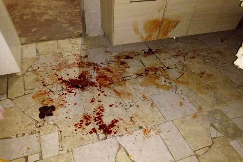Homem é morto a tiros e outro é baleado na mesma noite em Brumado Homem é morto a tiros e outro é baleado na mesma noite em Brumado