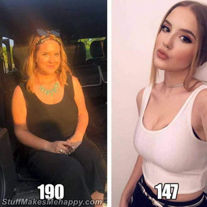 20 People Before and After Severe Weight Loss, Some of Them Have Lost Half Their Weight