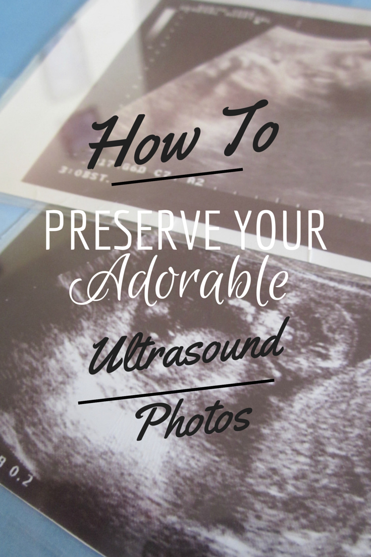 How to Preserve Your Adorable Ultrasound Photos City of Creative Dreams