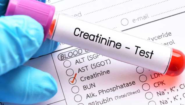 Creatinine Test