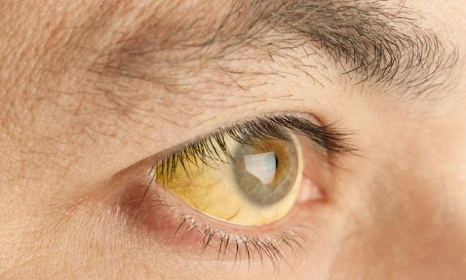 Καρκίνος στο πάγκρεας: 7 άγνωστα συμπτώματα του πιο θανατηφόρου καρκίνου