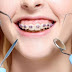 Niềng răng khi mất răng được không?