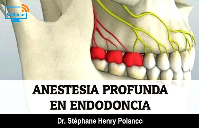 WEBINAR: Anestesia profunda en Endodoncia - Dr. Stéphane Henry Polanco