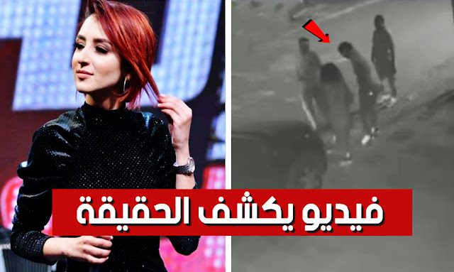 فيديو يكشف حقيقة نهش كلب لوجه الفنانة ريم النقاش