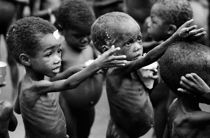 Image result for kids dying in africa of malnutrition