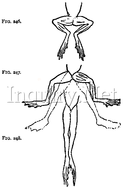 From RPN/LPN to Registered Nurse (RN) - Now for the rest of my life ...