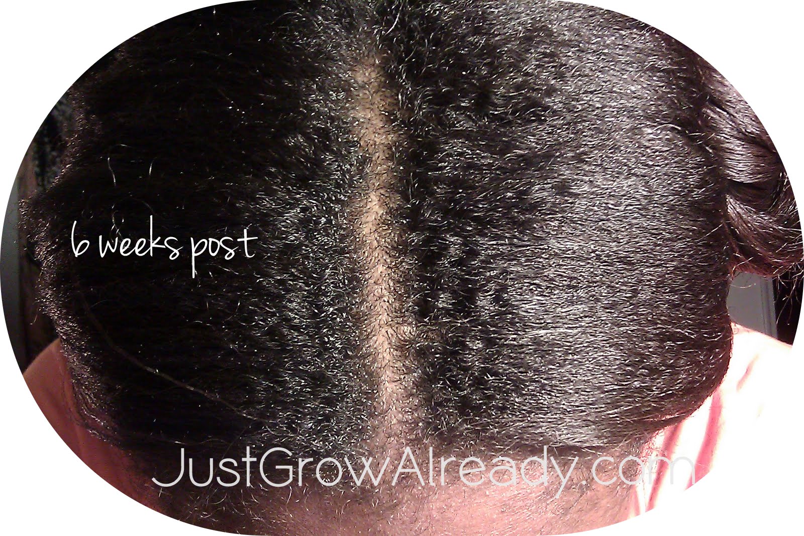 Hair Babble | Just Grow Already!