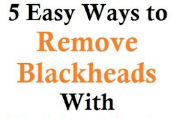 5 Easy Ways to Remove Blackheads With Baking Soda