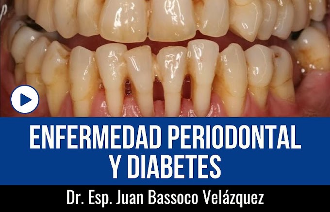 WEBINAR: Enfermedad Periodontal y Diabetes - Dr. Esp. Juan Bassoco Velázquez