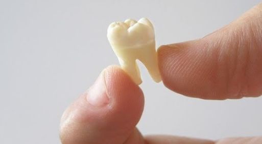 Rekomendasi Mimpi Gigi Copot Tapi Tumbuh Lagi