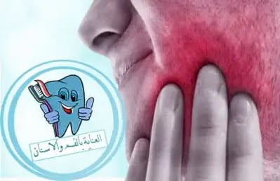 افضل مضاد حيوي للاسنان لـ تسكين الم الاسنان والتهاب الاسنان
