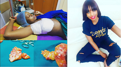 Makosi Former Big Brother U.K contestant, Makosi Musambasi undergoes success surgery to remove lumps from her breast