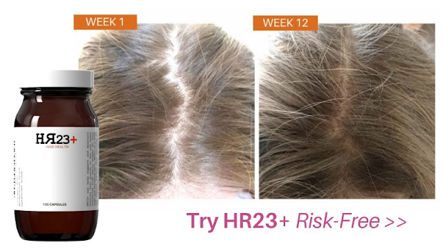 hair growth supplement