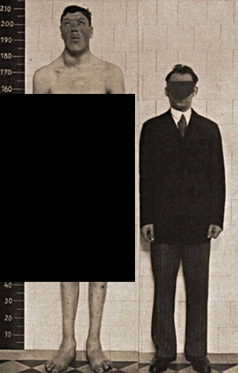 حالة أدم راينر الغريبة