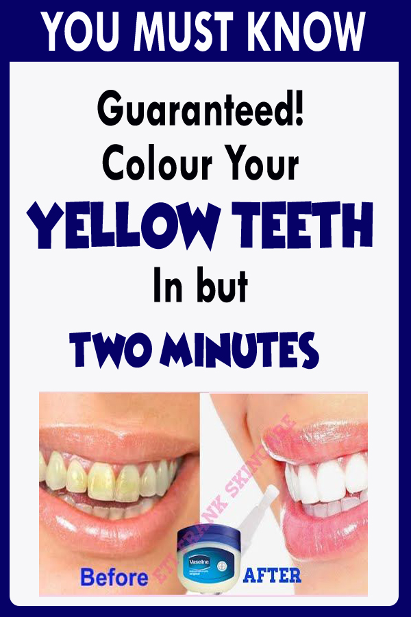 Guaranteed! Colour Your Yellow Teeth In but two Minutes!