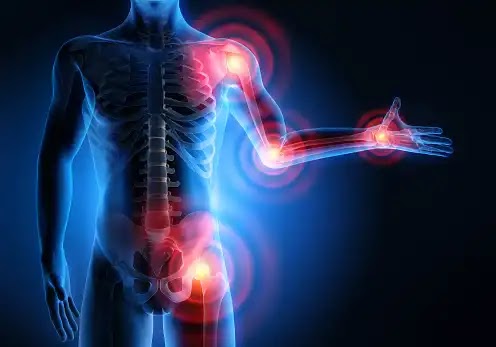 10 causes of bone pain you should be avoided Bone pain
