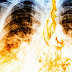 Σε πόσο καιρό θα καθαρίσουν οι πνεύμονές σας αν κόψετε σήμερα το κάπνισμα