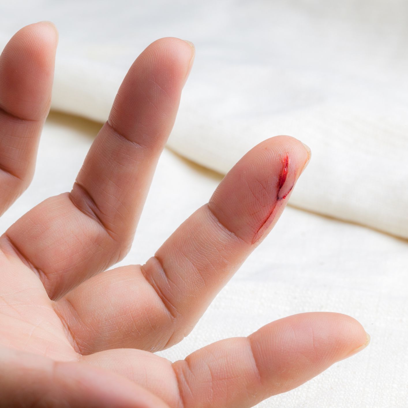 8+ Arti Mimpi Jari Telunjuk Kena Pisau