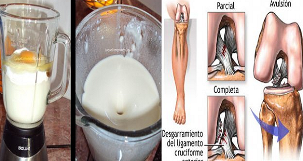ESTA MUJER ELIMINADO RODILLA Y DOLOR DE LAS ARTICULACIONES EN UN DÍA SIN IR AL MÉDICO. ELLA USARÁ ESTE !!! ESTA MUJER ELIMINADO RODILLA Y DOLOR DE LAS ARTICULACIONES EN UN DÍA SIN IR AL MÉDICO. ELLA USARÁ ESTE !!!