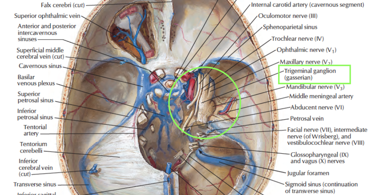 Head and Neck Anatomy: Trigeminal Ganglion