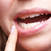 Yếu tố ảnh hưởng đến kết quả niềng răng 