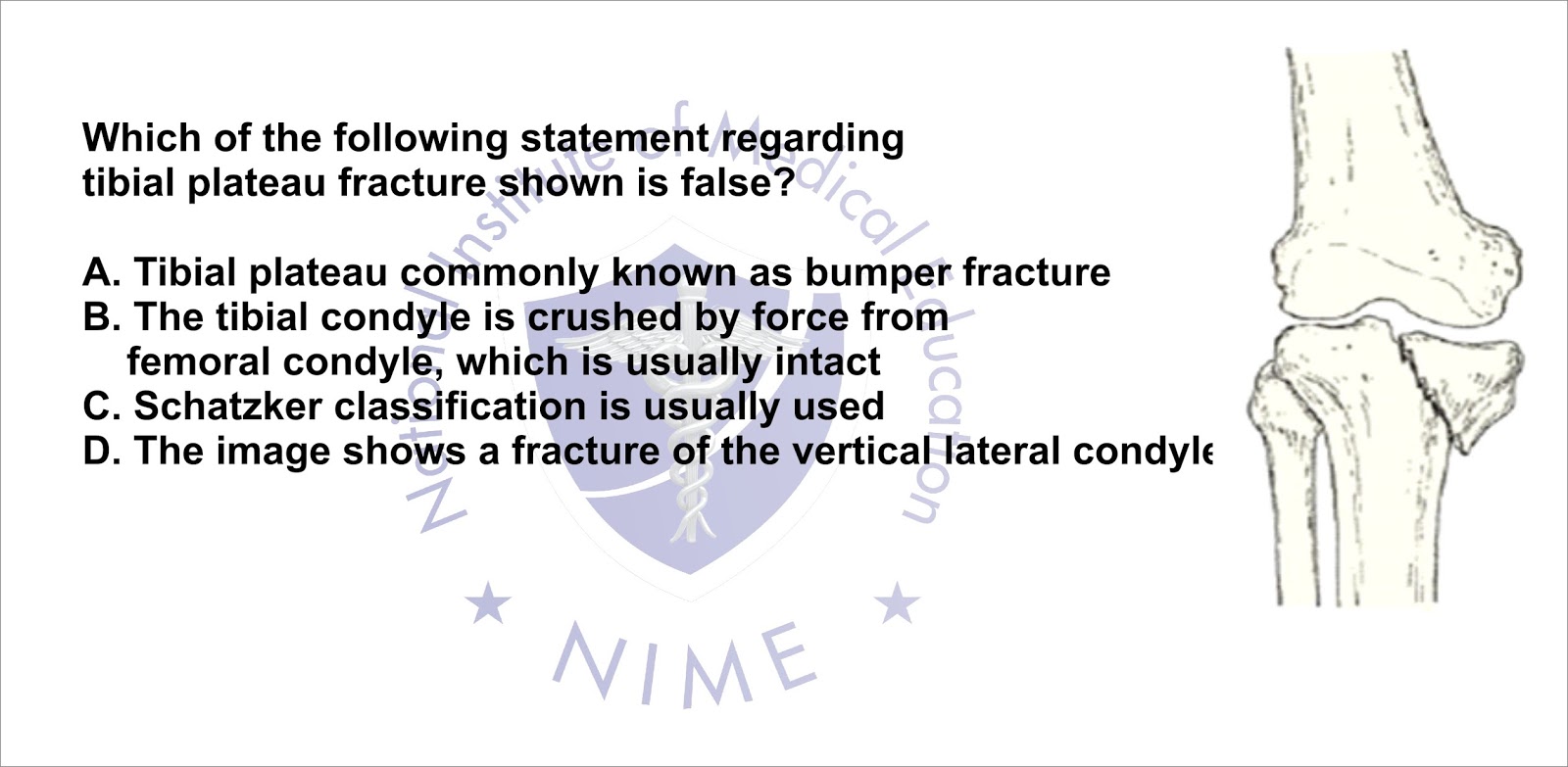 Tibial Plateau Bumper Fracture Symptoms Causes Treatm vrogue.co