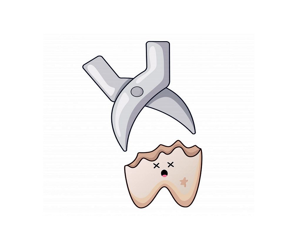 icare oral surgery icare oral surgery