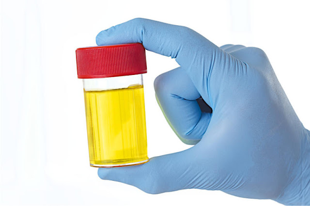 What Are Urinary Tract Infections (UTIs)? - Media Tunes