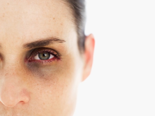 best eye creams for dark circles malaysia best eye creams for dark circles malaysia