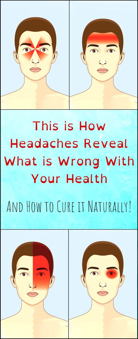 This Is How Headaches Reveal What Is Wrong With Your Health Healthy