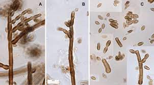 Hormodendrum sp. Hormodendrum sp.