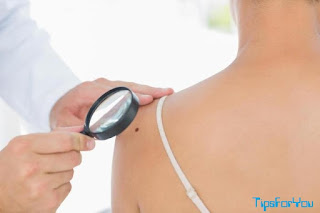 What is the latest treatment for melanoma,What is the most effective treatment for melanoma,Is Stage 3 melanoma a death sentence,What is the best treatment for stage 3 melanoma,melanoma treatment breakthrough