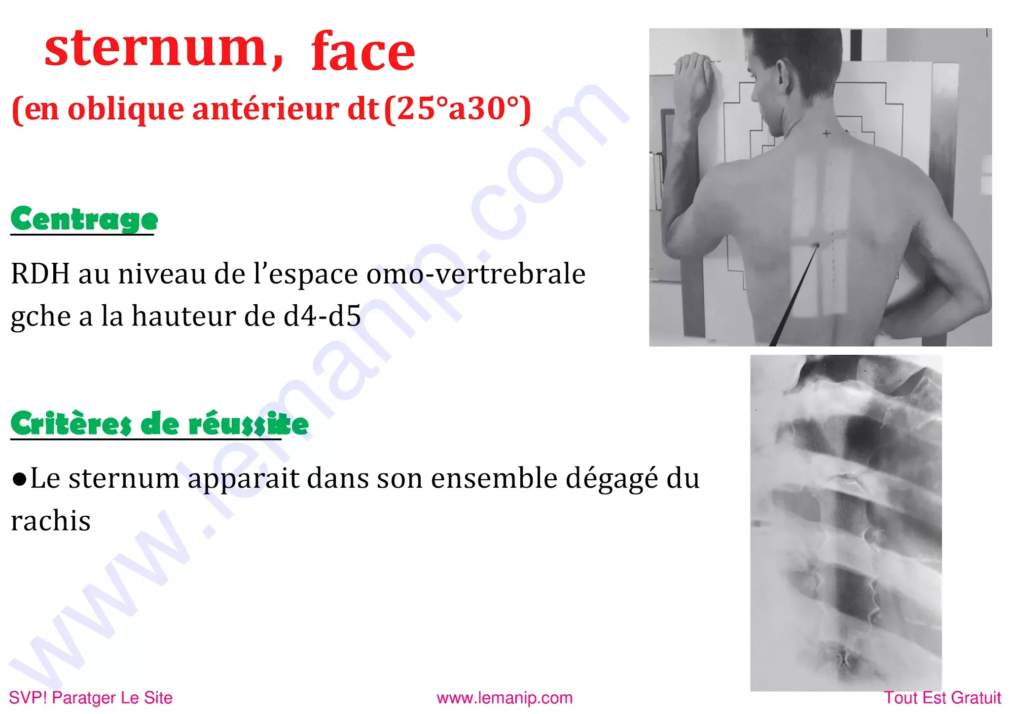 Sternum de face