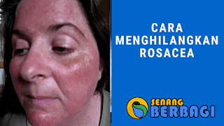 Cara menghilangkan rosacea secara alami