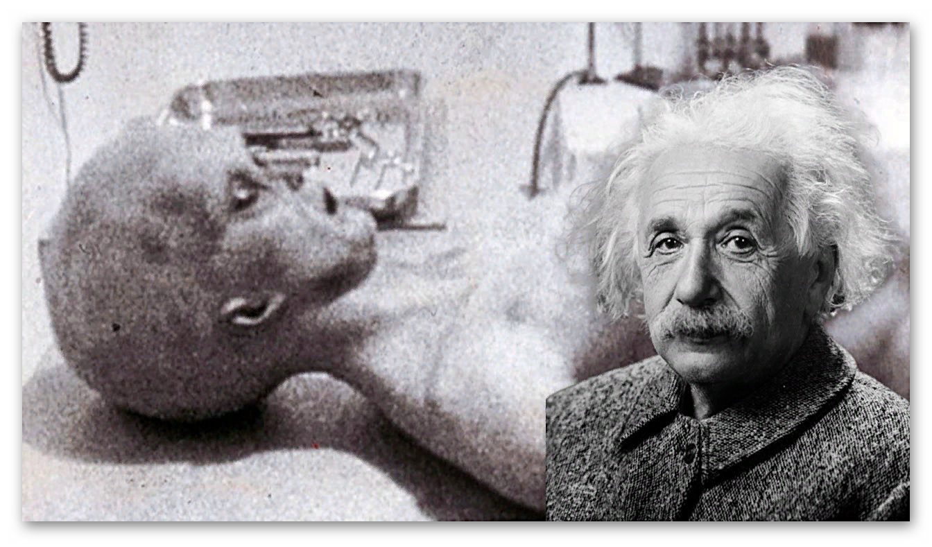 Как умер эйнштейн