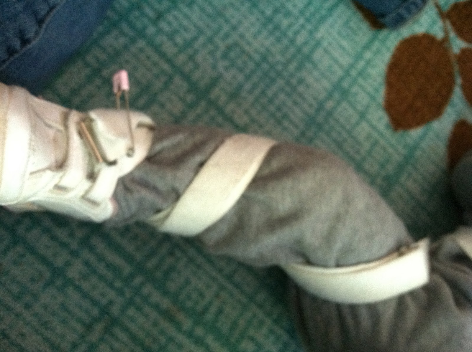 Rachel's Journey with Spina Bifida DeRotation Straps Tutorial