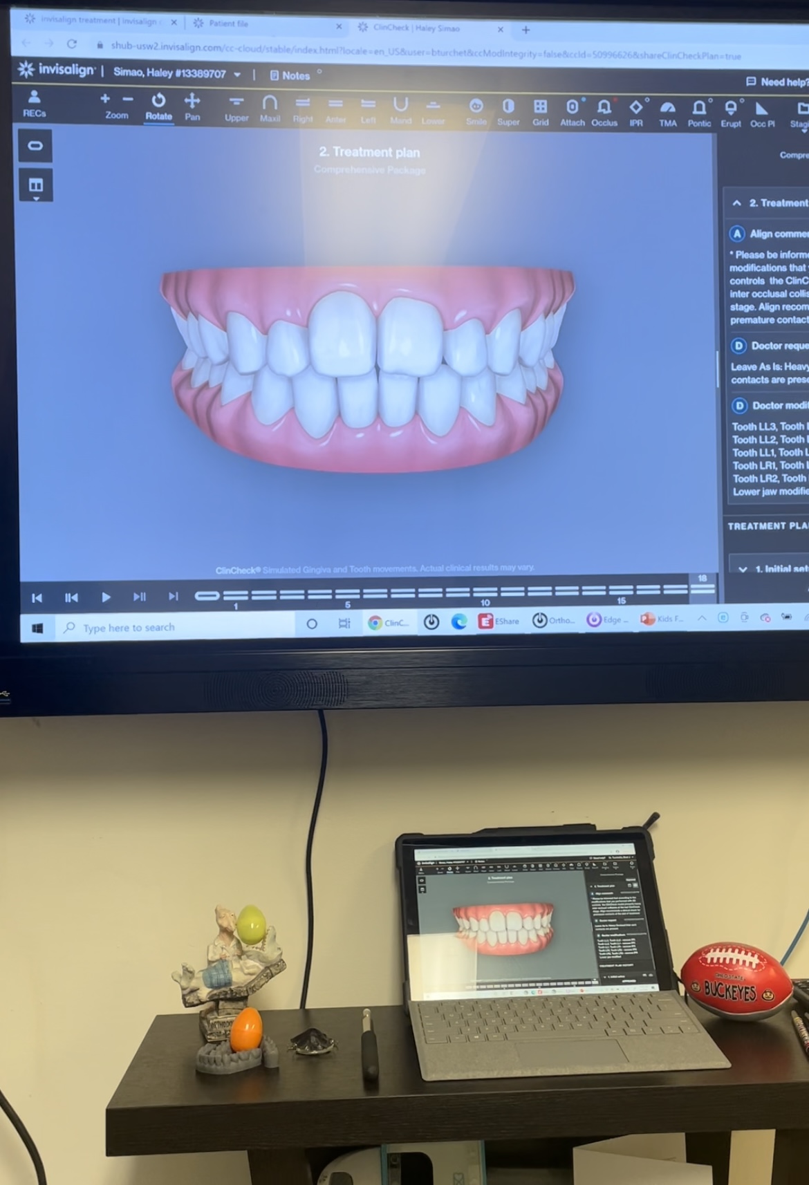 haleysimao Invisalign Treatment with RI Ortho Group Pre Treatment