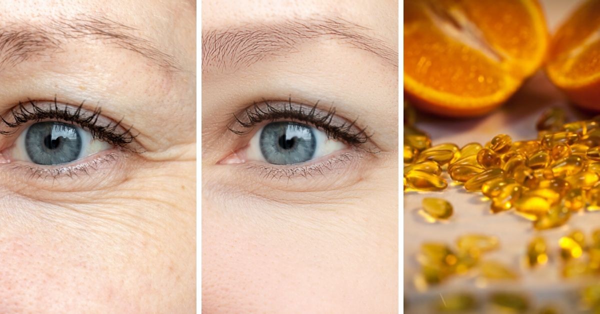 Voici comment utiliser la vitamine C sur le visage pour un effet botox (recette maison)