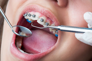 best orthodontist Melbourne