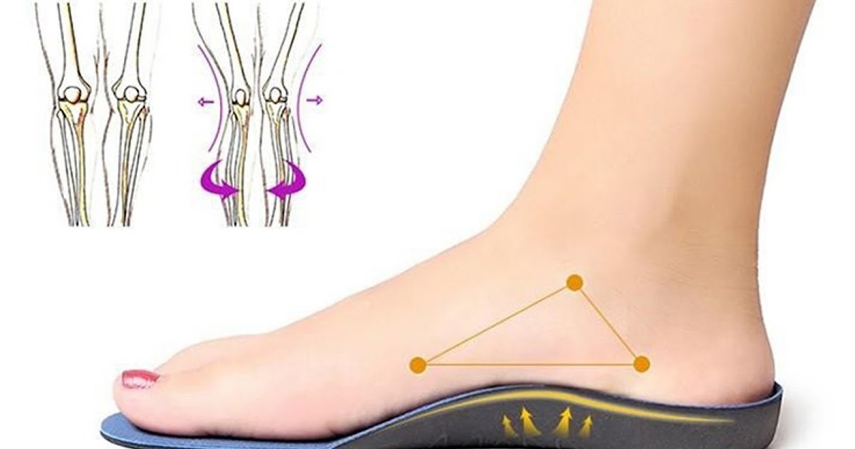 Tapaswini Why Ballet Flats for Bunions Dallas are Ideal for Women